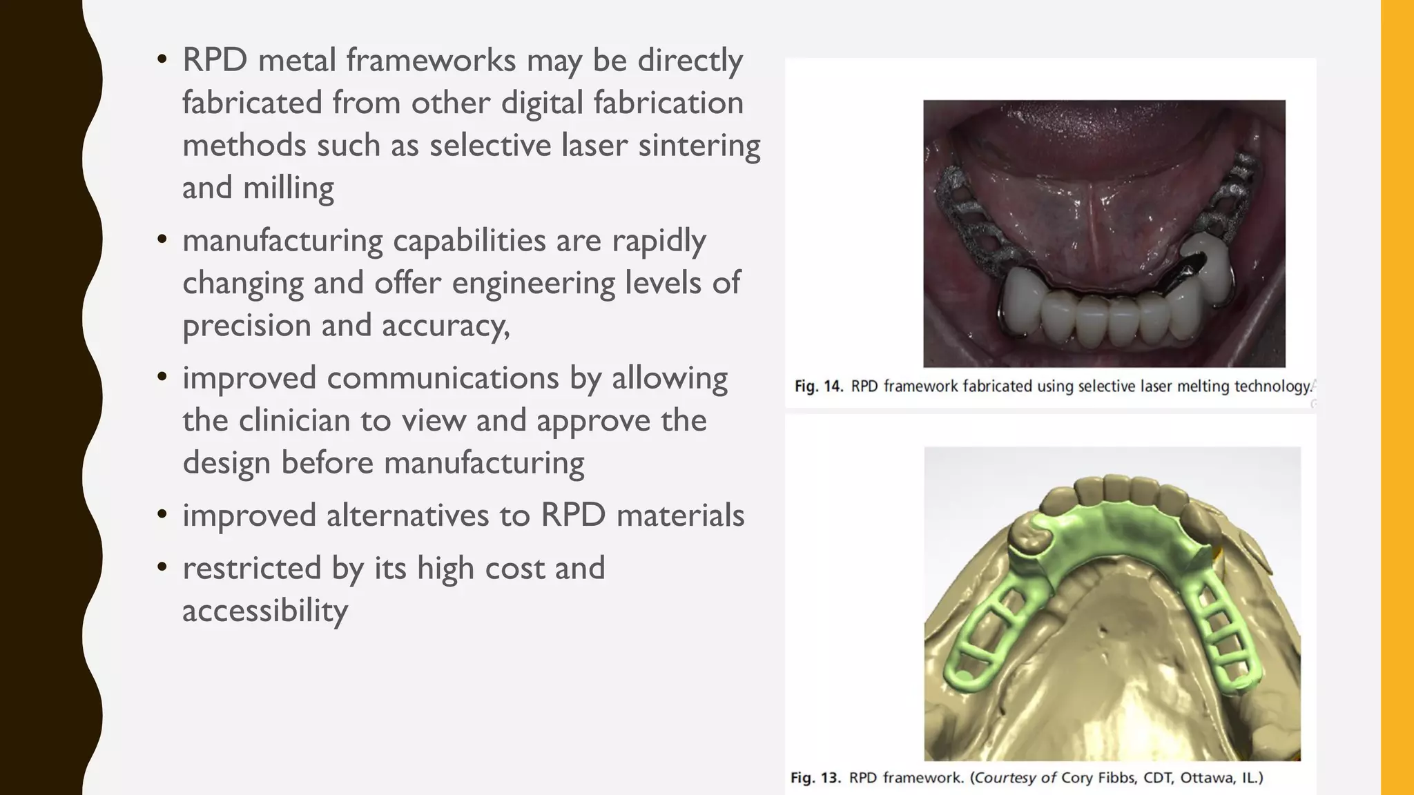 RECENT ADVANCES IN REMOVABLE PARTIAL DENTURES | PDF