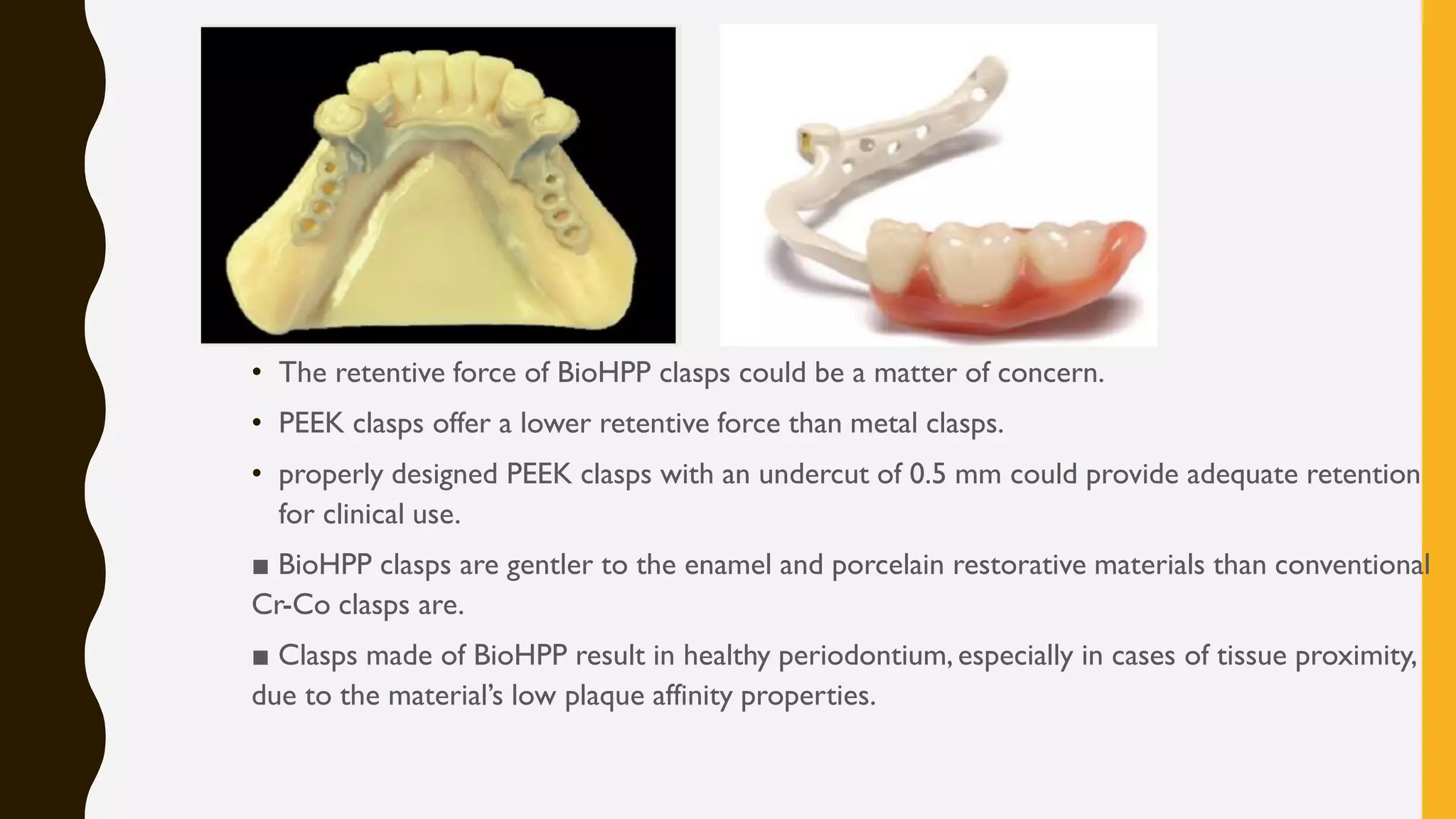 Removable Partial Denture Recent Advances – GAWPGS