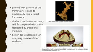 • printed wax pattern of the
framework is used to
traditionally cast a metal
framework.
• similar, if not better, accuracy
and fit compared with those
fabricated by traditional
methods.
• better 3D visualization for
designing framework for
students.
 