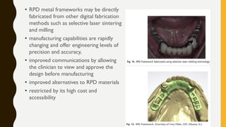 • RPD metal frameworks may be directly
fabricated from other digital fabrication
methods such as selective laser sintering
and milling
• manufacturing capabilities are rapidly
changing and offer engineering levels of
precision and accuracy,
• improved communications by allowing
the clinician to view and approve the
design before manufacturing
• improved alternatives to RPD materials
• restricted by its high cost and
accessibility
 