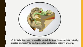 A digitally designed removable partial denture framework is virtually
created and ready to add sprues for perfactory pattern printing.
 