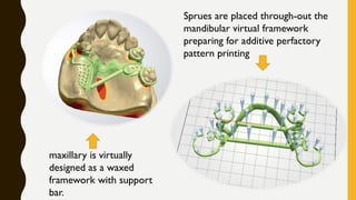 maxillary is virtually
designed as a waxed
framework with support
bar.
Sprues are placed through-out the
mandibular virtual framework
preparing for additive perfactory
pattern printing
 
