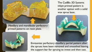 Maxillary and mandibular perfactory
printed patterns on resin plate.
The CadBlu 3D Systems
inkjet printed pattern is
another option with a solid
wax sprue base.
Envisontec perfactory maxillary partial pattern after
the sprues have been removed and smoothed leaving
the support bar for spruing to invest and then cast.
 