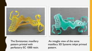 The Envisiontec maxillary
pattern printed with
perfactory EC 1000 resin.
An intaglio view of the same
maxillary 3D Systems inkjet printed
pattern.
 