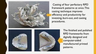 Casting of four perfactory RPD
framework patterns at once.This
casting technique improves
efficiency and productivity for
investing, burn-out, and casting
procedures.
The finished and polished
RPD frameworks from
digitally designed and
computer-aided
manufactured printed
patterns.
 