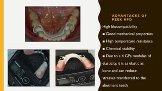 A DVA N TAG E S O F
P E E K R P D
High biocompatibility
■ Good mechanical properties
■ High temperature resistance
■ Chemical stability
■ Due to a 4 GPa modulus of
elasticity, it is as elastic as
bone and can reduce
stresses transferred to the
abutment teeth
 