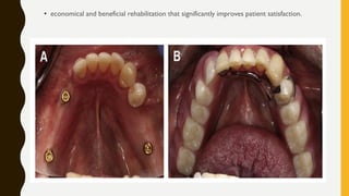• economical and beneficial rehabilitation that significantly improves patient satisfaction.
 
