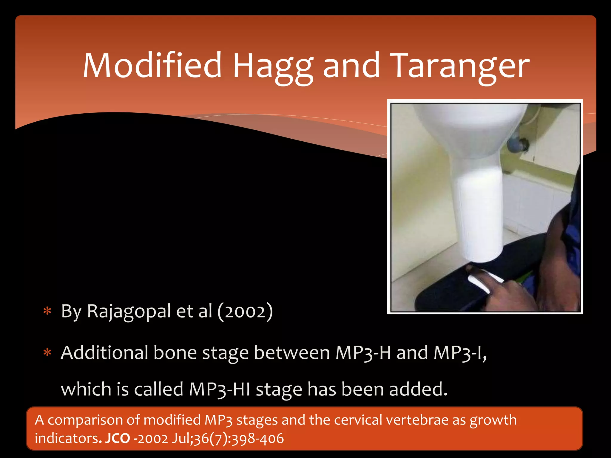  By Rajagopal et al (2002)
 Additional bone stage between MP3-H and MP3-I,
which is called MP3-HI stage has been added.
Modified Hagg and Taranger
A comparison of modified MP3 stages and the cervical vertebrae as growth
indicators. JCO -2002 Jul;36(7):398-406
 