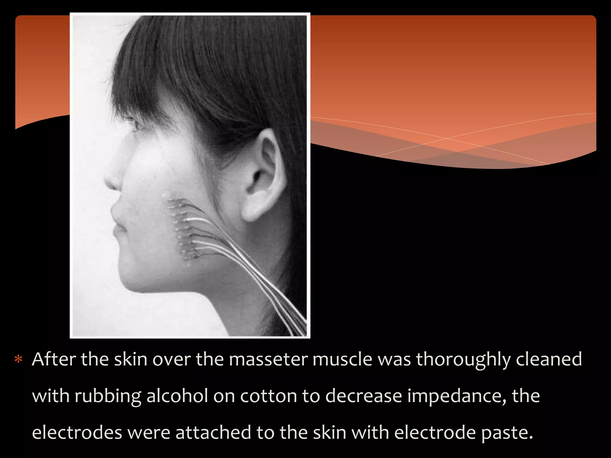  After the skin over the masseter muscle was thoroughly cleaned
with rubbing alcohol on cotton to decrease impedance, the
electrodes were attached to the skin with electrode paste.
 