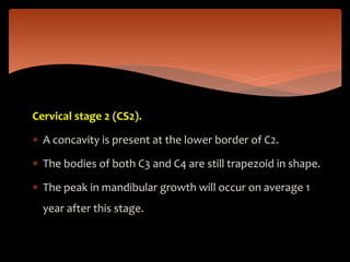 Cervical stage 2 (CS2).
 A concavity is present at the lower border of C2.
 The bodies of both C3 and C4 are still trapezoid in shape.
 The peak in mandibular growth will occur on average 1
year after this stage.
 