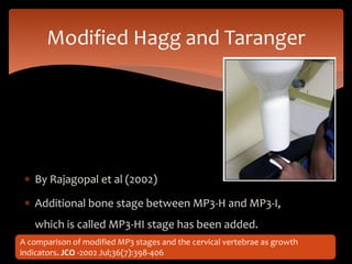  By Rajagopal et al (2002)
 Additional bone stage between MP3-H and MP3-I,
which is called MP3-HI stage has been added.
Modified Hagg and Taranger
A comparison of modified MP3 stages and the cervical vertebrae as growth
indicators. JCO -2002 Jul;36(7):398-406
 