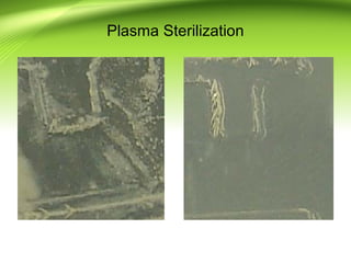 Plasma Sterilization
 