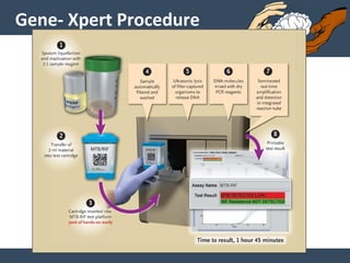 Gene- Xpert Procedure
 