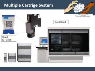 Multiple Cartrige System
 