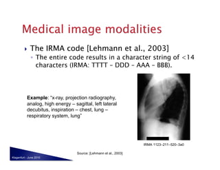     The IRMA code [Lehmann et al., 2003]
              ◦  The entire code results in a character string of <14
                 characters (IRMA: TTTT – DDD – AAA – BBB).




           Example: “x-ray, projection radiography,
           analog, high energy – sagittal, left lateral
           decubitus, inspiration – chest, lung –
           respiratory system, lung”




                                   Source: [Lehmann et al., 2003]
Klagenfurt - June 2010
 