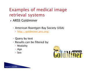     ARSS Goldminer

              ◦  American Roentgen Ray Society (USA)
                    http://goldminer.arrs.org/

              ◦  Query by text
              ◦  Results can be filtered by:
                    Modality
                    Age
                    Sex




Klagenfurt - June 2010
 