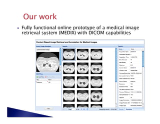    Fully functional online prototype of a medical image
     retrieval system (MEDIX) with DICOM capabilities
 