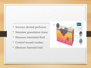 • Increase dermal perfusion
• Stimulate granulation tissue
• Decrease interstitial fluid
• Control wound exudate
• Decrease bacterial load
 