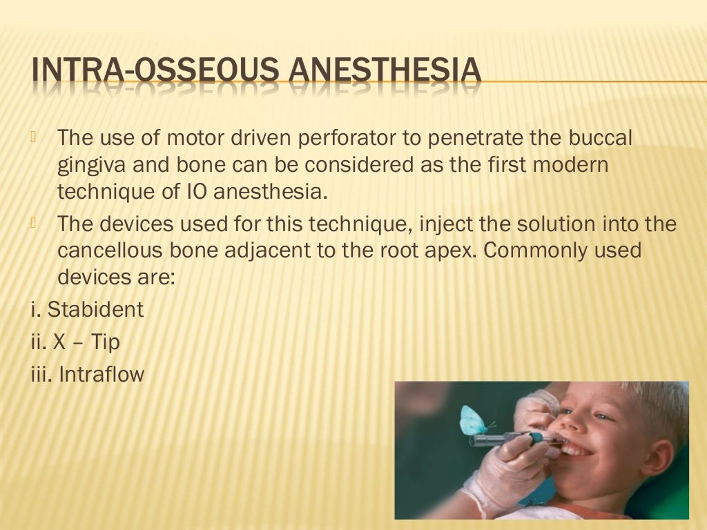 Recent Advances in local Anaesthesia in dentistry