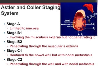 Coller Not Recent advances on colo rectal carcinoma1 | PPTX