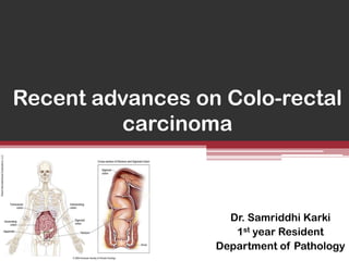 Recent advances on Colo-rectal
carcinoma

Dr. Samriddhi Karki
1st year Resident
Department of Pathology

 