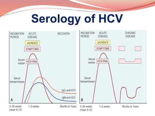 Recent advances in chronic hepatitis | PPTX