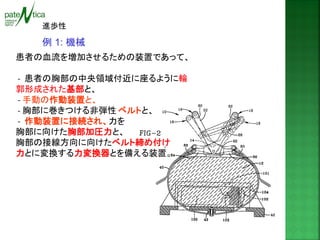 例 1: 機械 
患者の血流を増加させるための装置であって、 
- 患者の胸部の中央領域付近に座るように輪 郭形成された基部と、 
- 手動の作動装置と、 
- 胸部に巻きつける非弾性 ベルトと、 
- 作動装置に接続され、力を 
胸部に向けた胸部加圧力と、 
胸部の接線方向に向けたベルト締め付け 
力とに変換する力変換器とを備える装置。 
進歩性  