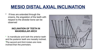Messially Angulated Recent concept of and about normal occlusion.pptx