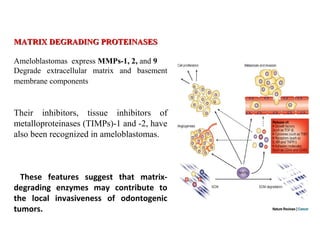 MATRIX DEGRADING PROTEINASESMATRIX DEGRADING PROTEINASES
Ameloblastomas express MMPs-1, 2, and 9
Degrade extracellular matrix and basement
membrane components
Their inhibitors, tissue inhibitors of
metalloproteinases (TIMPs)-1 and -2, have
also been recognized in ameloblastomas.
These features suggest that matrix-
degrading enzymes may contribute to
the local invasiveness of odontogenic
tumors.
 