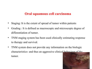 Oral squamous cell carcinoma
• Staging: It is the extent of spread of tumor within patients
• Grading : It is defined as macroscopic and microscopic degree of
differentiation of tumor.
• TNM staging system has been used clinically estimating response
to therapy and survival.
• TNM system does not provide any information on the biologic
characteristics- and thus an aggressive clinical behaviour of the
tumor.
 
