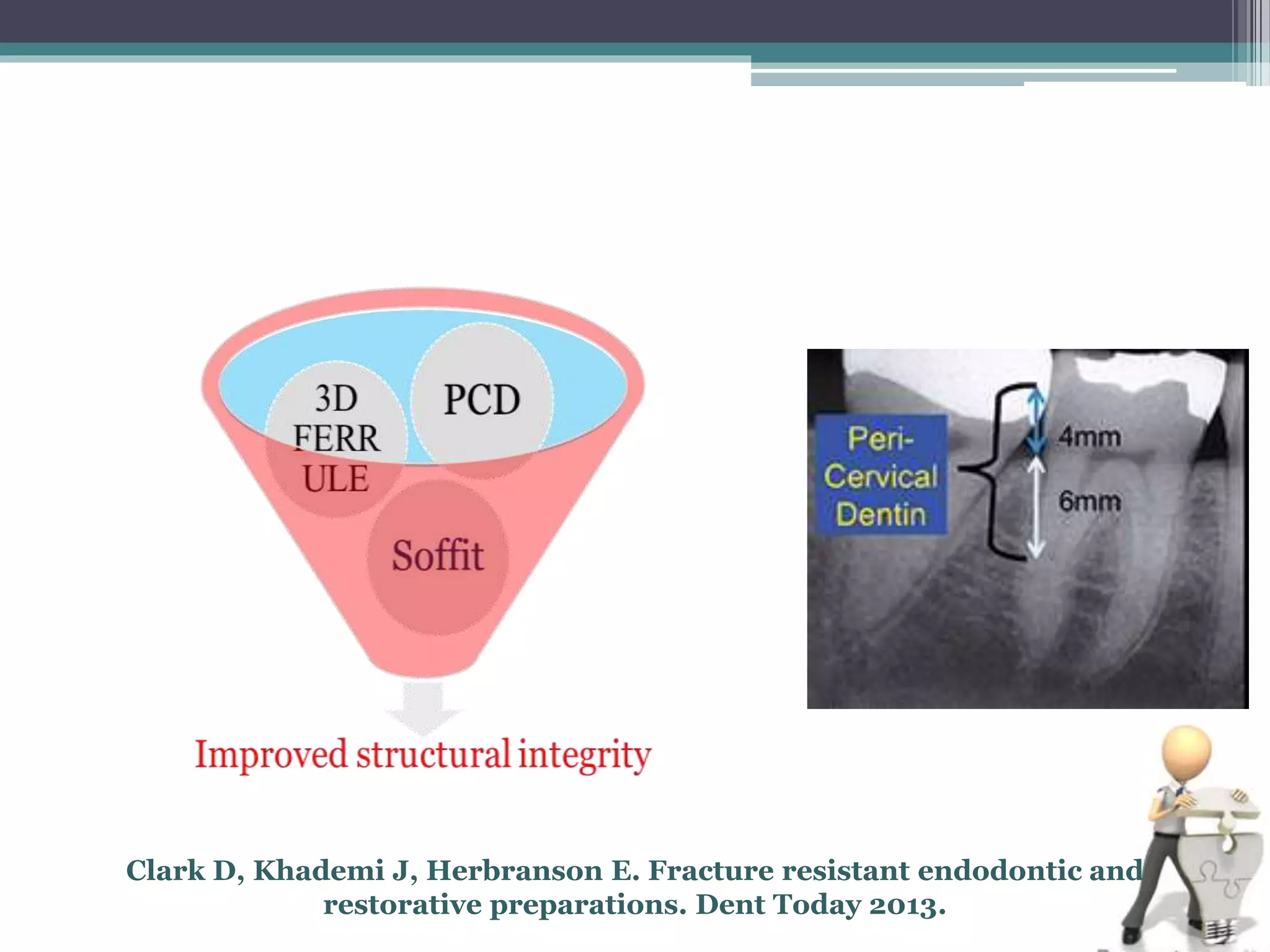 Recent concepts in post endodontic restorations | PPTX