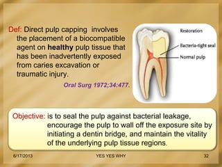 Pulp Def Recent concepts in vital pulp therapy Dr. Sarjeev Singh Yadav | PPTX