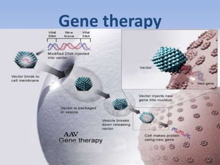 Gene therapy 
 