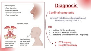 Summary of Comprehensive Review of Chronic Rhinosinusitis with Nasal ...
