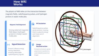 Comprehensive Overview of Magnetic Resonance Imaging (MRI) Technology ...