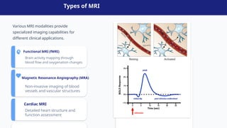 Comprehensive Overview of Magnetic Resonance Imaging (MRI) Technology ...