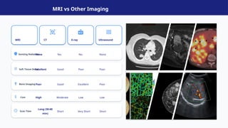 Comprehensive Overview of Magnetic Resonance Imaging (MRI) Technology ...