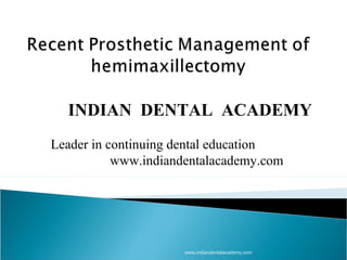 INDIAN DENTAL ACADEMY
Leader in continuing dental education
www.indiandentalacademy.com

www.indiandentalacademy.com

 
