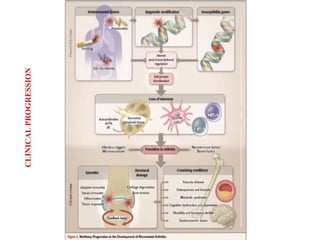 RECENT ADVANCES IN TREATMENT OF RHEUMATOID ARTHRITIS | PPTX