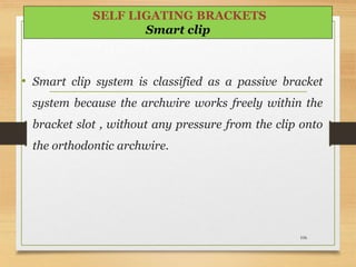 • Smart clip system is classified as a passive bracket
system because the archwire works freely within the
bracket slot , without any pressure from the clip onto
the orthodontic archwire.
106
SELF LIGATING BRACKETS
Smart clip
 