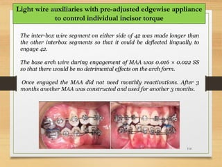 114
Light wire auxiliaries with pre-adjusted edgewise appliance
to control individual incisor torque
The inter-box wire segment on either side of 42 was made longer than
the other interbox segments so that it could be deflected lingually to
engage 42.
The base arch wire during engagement of MAA was 0.016 × 0.022 SS
so that there would be no detrimental effects on the arch form.
Once engaged the MAA did not need monthly reactivations. After 3
months another MAA was constructed and used for another 3 months.
 
