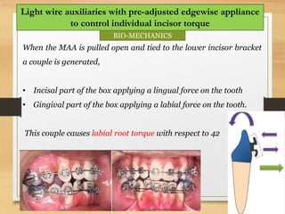 115
Light wire auxiliaries with pre-adjusted edgewise appliance
to control individual incisor torque
When the MAA is pulled open and tied to the lower incisor bracket
a couple is generated,
• Incisal part of the box applying a lingual force on the tooth
• Gingival part of the box applying a labial force on the tooth.
This couple causes labial root torque with respect to 42
BIO-MECHANICS
 