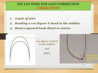 124
YIN YAN WIRE FOR CANT CORRECTION
FABRICATION
1. A pair of wire
2. Bending a 110 degree V-bend in the midline
3. Bend a upward hook distal to canine
110 degree V-bend
in the midline
and
Helix
 