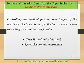 129
Torque and Intrusion Control of the Upper Incisors with
Modified Posted Archwire
Redento Peretta ,Luis Huanca Ghislanzoni,
Controlling the vertical position and torque of the
maxillary incisors is a particular concern when
correcting an excessive overjet,with
• Class II mechanics (elastics)
• Space closure after extraction
 