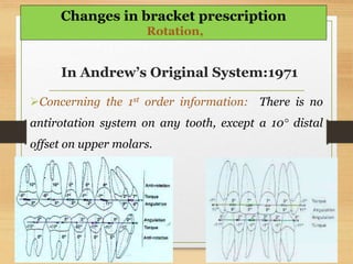 In Andrew’s Original System:1971
Concerning the 1st order information: There is no
antirotation system on any tooth, except a 10° distal
offset on upper molars.
Changes in bracket prescription
Rotation,
 
