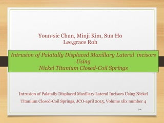 146
Intrusion of Palatally Displaced Maxillary Lateral incisors
Using
Nickel Titanium Closed-Coil Springs
Intrusion of Palatally Displaced Maxillary Lateral Incisors Using Nickel
Titanium Closed-Coil Springs, JCO-april 2015, Volume xlix number 4
Youn-sic Chun, Minji Kim, Sun Ho
Lee,grace Roh
 