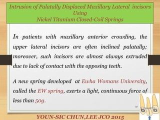 147
Intrusion of Palatally Displaced Maxillary Lateral incisors
Using
Nickel Titanium Closed-Coil Springs
YOUN-SIC CHUN,LEE JCO 2015
In patients with maxillary anterior crowding, the
upper lateral incisors are often inclined palatally;
moreover, such incisors are almost always extruded
due to lack of contact with the opposing teeth.
A new spring developed at Ewha Womans University,
called the EW spring, exerts a light, continuous force of
less than 50g.
 