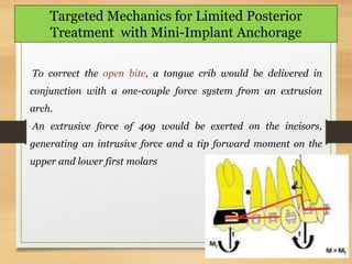 151
Targeted Mechanics for Limited Posterior
Treatment with Mini-Implant Anchorage
To correct the open bite, a tongue crib would be delivered in
conjunction with a one-couple force system from an extrusion
arch.
An extrusive force of 40g would be exerted on the incisors,
generating an intrusive force and a tip forward moment on the
upper and lower first molars
 