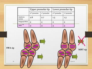 Upper premolar tip Lower premolar tip
2nd premolar 1st premolar 2nd premolar 1st premolar
Andrews
norms
2.8 2.7 1.5 1.3
Original SWA 2 2 2 2
MBT
TM
0 0 2 2
SWA tip
MBT tip
5-Jun-1634
 