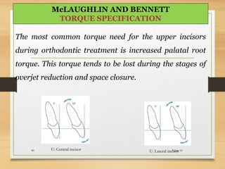 U: Central incisor U: Lateral incisor
The most common torque need for the upper incisors
during orthodontic treatment is increased palatal root
torque. This torque tends to be lost during the stages of
overjet reduction and space closure.
5-Jun-1640
McLAUGHLIN AND BENNETT
TORQUE SPECIFICATION
 